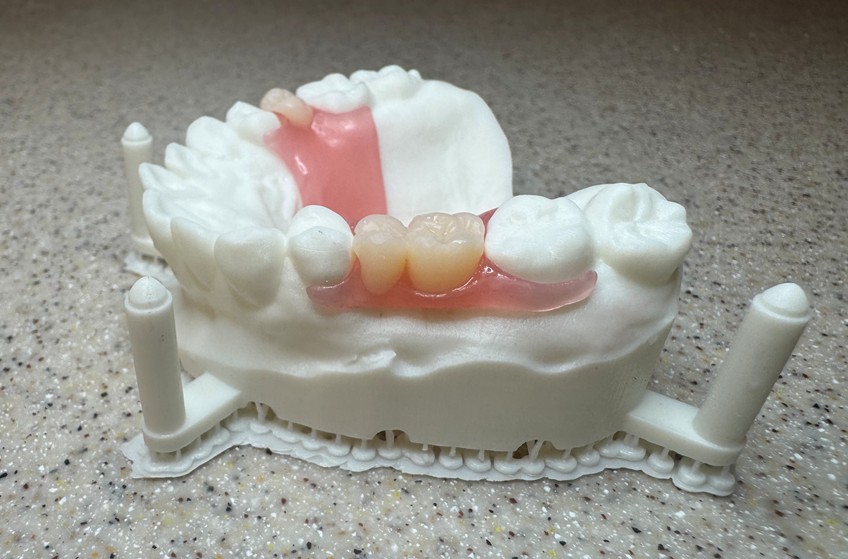 Partial Dentures in Newaygo
